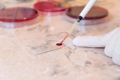 Blood Testing Could Catch Cancers Early, Projections Say